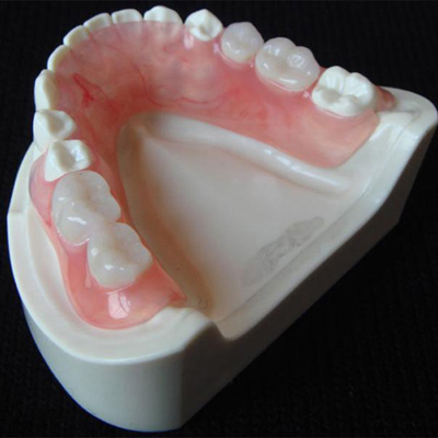 固定类纯钛超瓷牙  固定类氧化锆全瓷牙 氧化锆全瓷牙