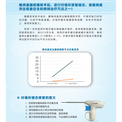 纤维环缝合器挂网